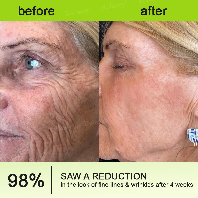 🧠👨‍⚕️Made and shipped from the USA 💫LUMIVO® moringa & Vita-A Retinol Shot Wrinkle-Lift Tightening cream -Last Day Promotion 70% OFF