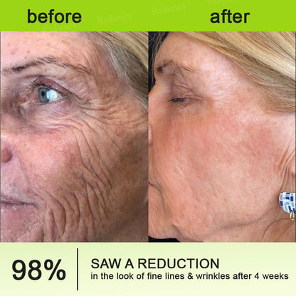 🧠👨‍⚕️Made and shipped from the USA 💫LUMIVO® moringa & Vita-A Retinol Shot Wrinkle-Lift Tightening cream -Last Day Promotion 70% OFF